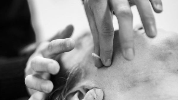 Dry needling